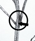 Figure Showing a Codominate Stem on a tree